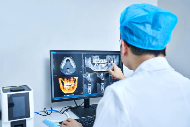 Best Emergency Dental Extractions in Kearny, NJ